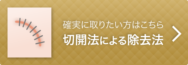 切開法による除去法